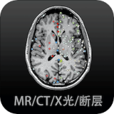 Ӱ�����ͼ��app���أ�Ӱ�����ͼ��v4.5.8��׿��app����